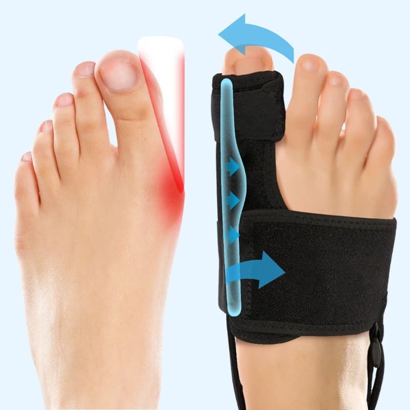 Omax™ - L'Orthèse Hallux Valgus Discrète et Légère