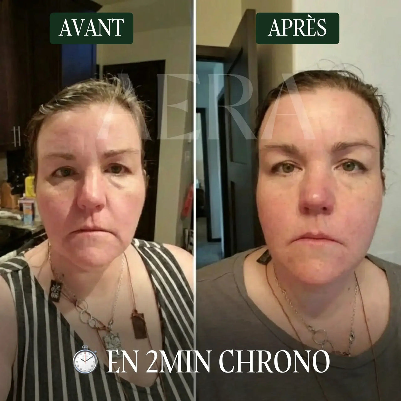 Brosse Lymphatique Visage AENA™